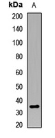 CNOT8 Rabbit Polyclonal Antibody