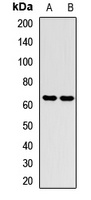 SETD3 Rabbit Polyclonal Antibody
