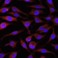 NEDD4L Rabbit Polyclonal Antibody