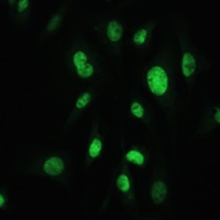 MDC1 Rabbit Polyclonal Antibody