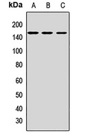 CD163 Rabbit Polyclonal Antibody