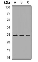 GNB2 Rabbit Polyclonal Antibody