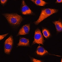 GNB2 Rabbit Polyclonal Antibody