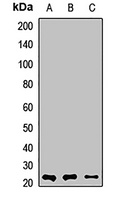MYL1 Rabbit Polyclonal Antibody