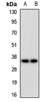 Endomucin Rabbit Polyclonal Antibody