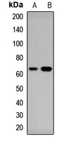 RARS2 Rabbit Polyclonal Antibody