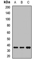 TEFM Rabbit Polyclonal Antibody