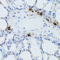 TEFM Rabbit Polyclonal Antibody