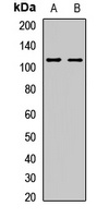 Herc3 Rabbit Polyclonal Antibody