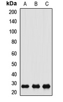 CACYBP Rabbit Polyclonal Antibody