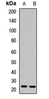 Prefoldin 3 Rabbit Polyclonal Antibody