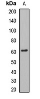 NP60 Rabbit Polyclonal Antibody