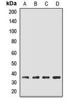 EBP2 Rabbit Polyclonal Antibody