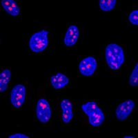 EBP2 Rabbit Polyclonal Antibody