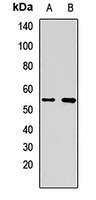 ME2 Rabbit Polyclonal Antibody