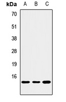 NOXA Rabbit Polyclonal Antibody