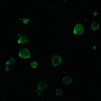 NOXA Rabbit Polyclonal Antibody