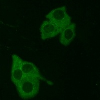 BCKDHA Rabbit Polyclonal Antibody