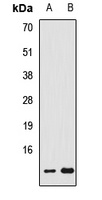 FDX1 Rabbit Polyclonal Antibody