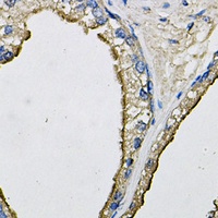 LCN1 Rabbit Polyclonal Antibody