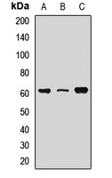 RPE65 Rabbit Polyclonal Antibody