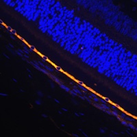 RPE65 Rabbit Polyclonal Antibody
