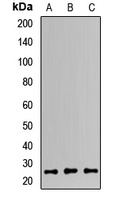 MAD2L2 Rabbit Polyclonal Antibody
