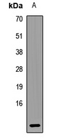 UQCRQ Rabbit Polyclonal Antibody
