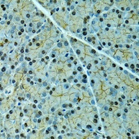 Alpha-2-antiplasmin Rabbit Polyclonal Antibody