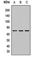 SOCS6 Rabbit Polyclonal Antibody