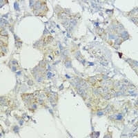 SOCS6 Rabbit Polyclonal Antibody