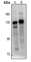 BUB1B Rabbit Polyclonal Antibody