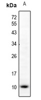 CCL5 Rabbit Polyclonal Antibody