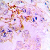 CCL5 Rabbit Polyclonal Antibody