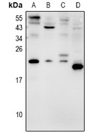 AVP Rabbit Polyclonal Antibody