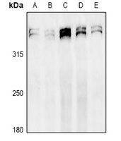 Ki67 Rabbit Polyclonal Antibody