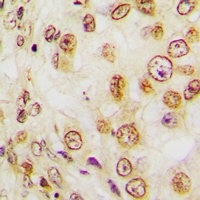 Ki67 Rabbit Polyclonal Antibody