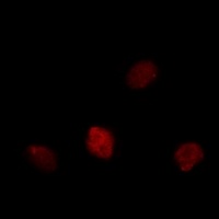 Ki67 Rabbit Polyclonal Antibody