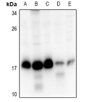 RPS15 Rabbit Polyclonal Antibody