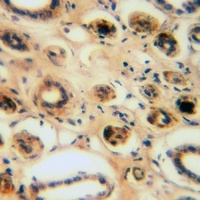 CEP95 Rabbit Polyclonal Antibody