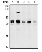 CNGA1 Rabbit Polyclonal Antibody