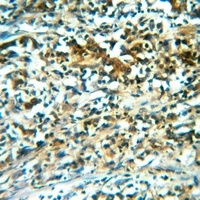 CNGA1 Rabbit Polyclonal Antibody