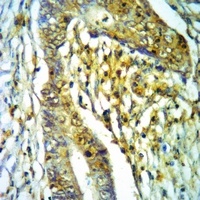 CD45 Rabbit Polyclonal Antibody