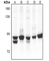 PKC alpha Rabbit Polyclonal Antibody