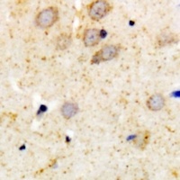 PKC alpha Rabbit Polyclonal Antibody