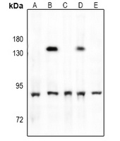 TBK1 (Phospho-S172) Rabbit Polyclonal Antibody