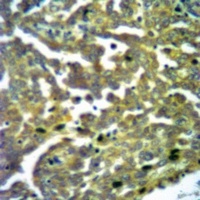 TBK1 (Phospho-S172) Rabbit Polyclonal Antibody
