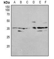 OTUB1 Rabbit Polyclonal Antibody