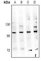 TBK1 Rabbit Polyclonal Antibody