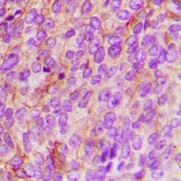 TBK1 Rabbit Polyclonal Antibody